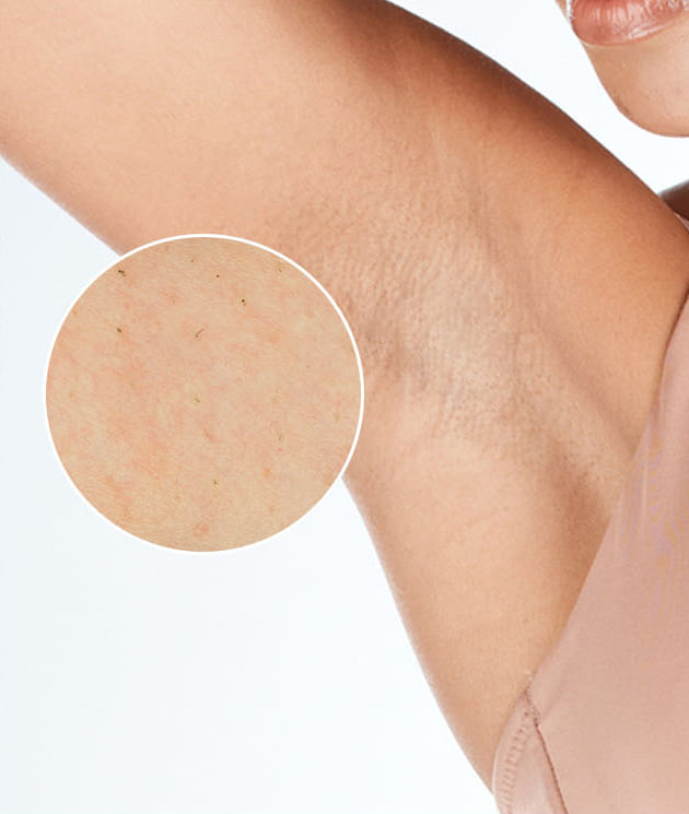 Po 3 o&scaron;etřen&iacute;ch