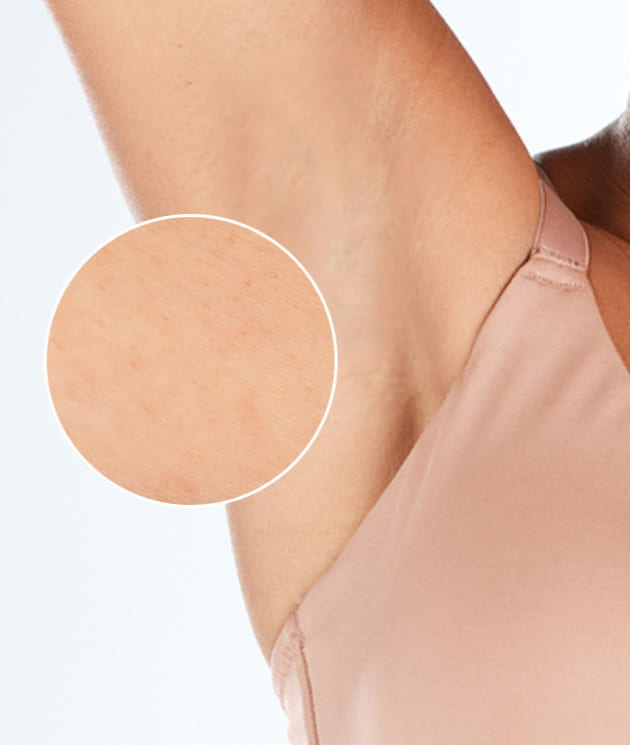 Po v&scaron;ech o&scaron;etřen&iacute;ch