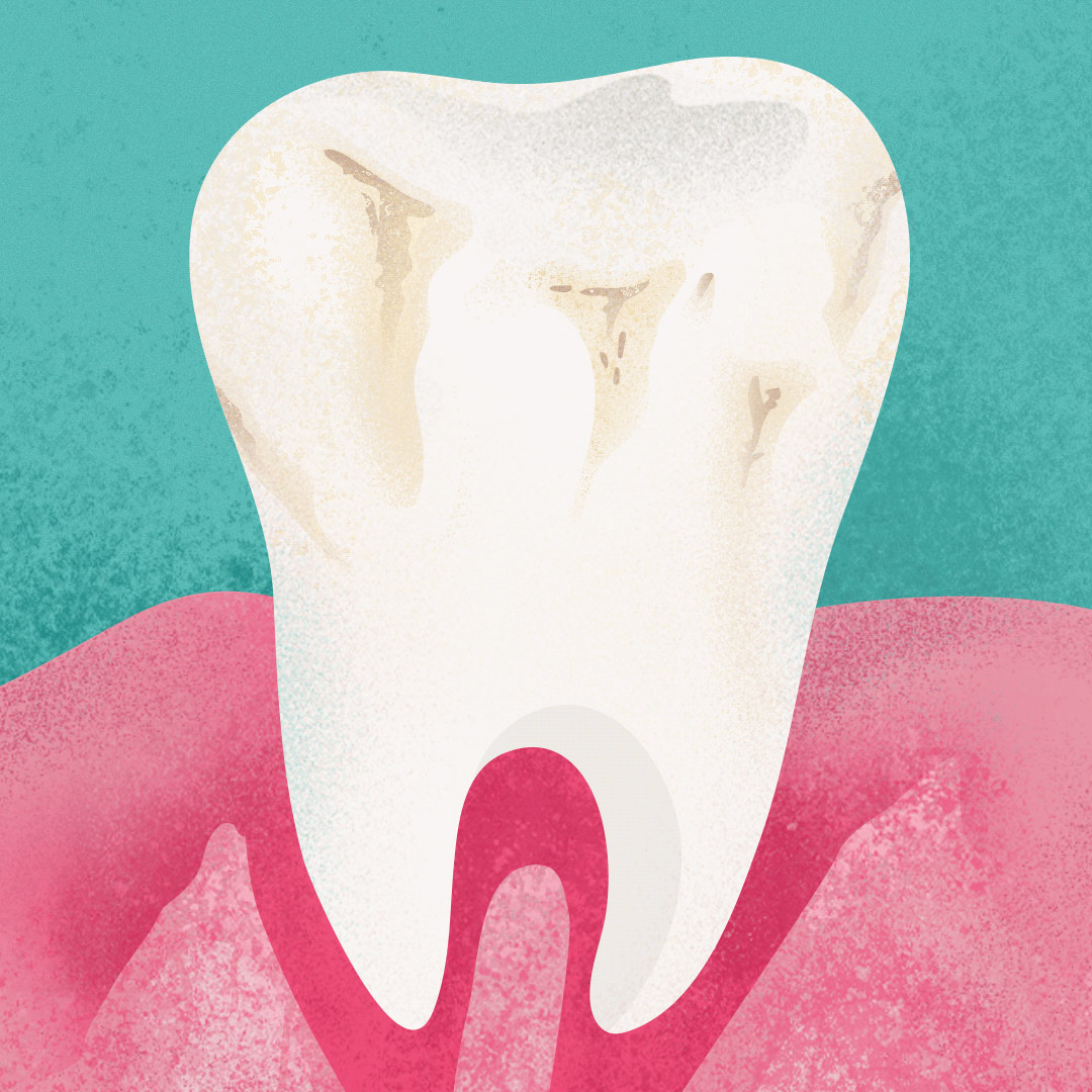 Kart&aacute;čkov&eacute; hlavice vyměňte každ&eacute; 3&nbsp;měs&iacute;ce, ikona