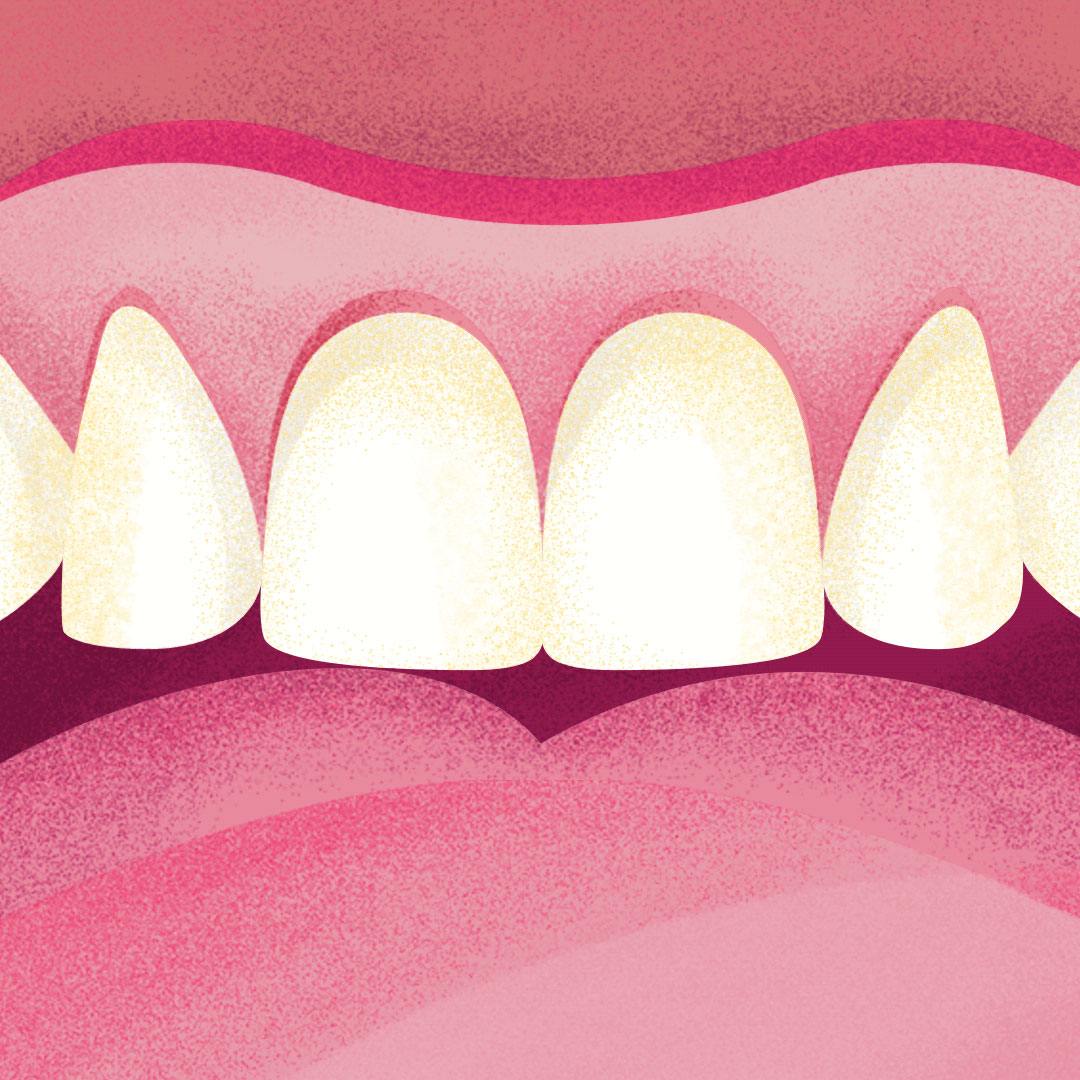 Kart&aacute;čkov&eacute; hlavice vyměňte každ&eacute; 3&nbsp;měs&iacute;ce, ikona