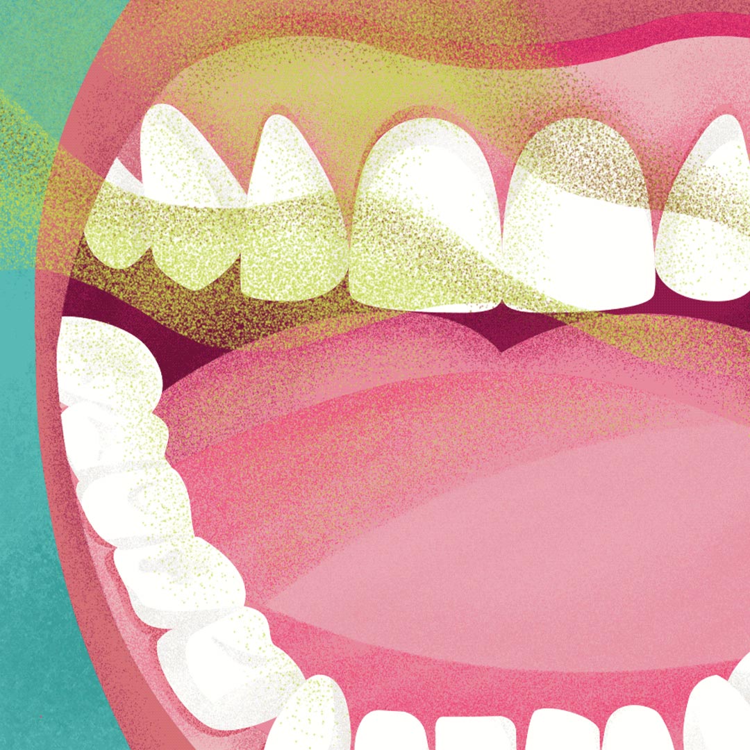 Kart&aacute;čkov&eacute; hlavice vyměňte každ&eacute; 3&nbsp;měs&iacute;ce, ikona