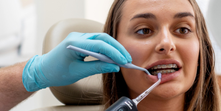 Jak na čištění zubů s fixními rovnátky?