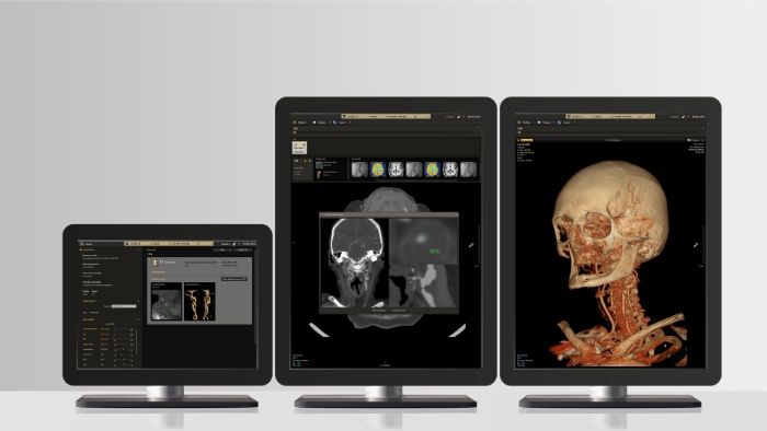 B&yacute;t partnerem zdravotn&iacute;ků je prioritou společnosti Philips