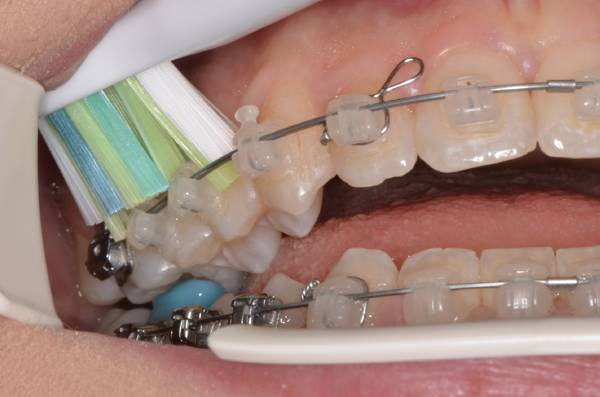 Technika či&scaron;těn&iacute;