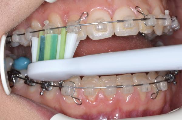 Technika či&scaron;těn&iacute;