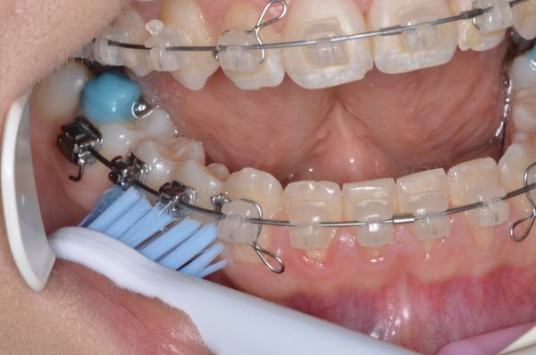 Technika či&scaron;těn&iacute;