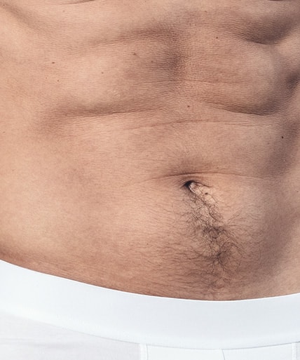 &Uacute;prava rozkroku