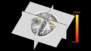 multi modality viewer